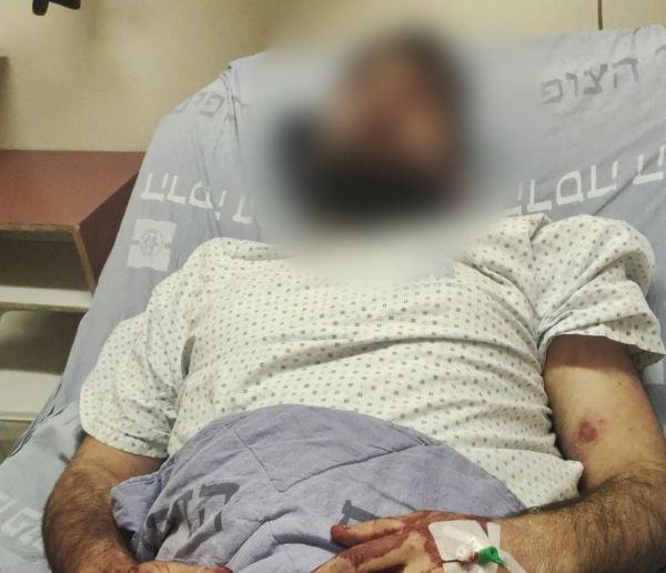 ירושלים: שני אחים נפצעו בקטטה עם פועלים ערבים