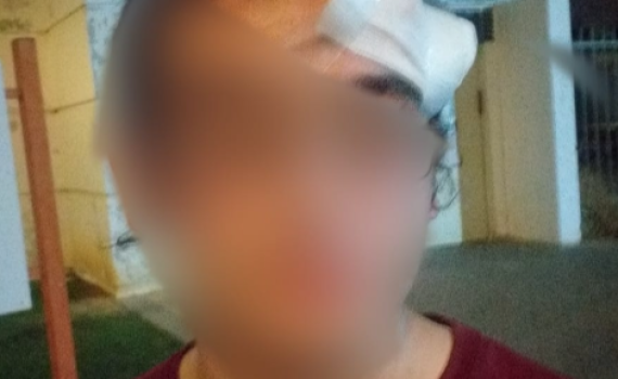 פורעים פרצו לסניף בני עקיבא ופצעו חניכים