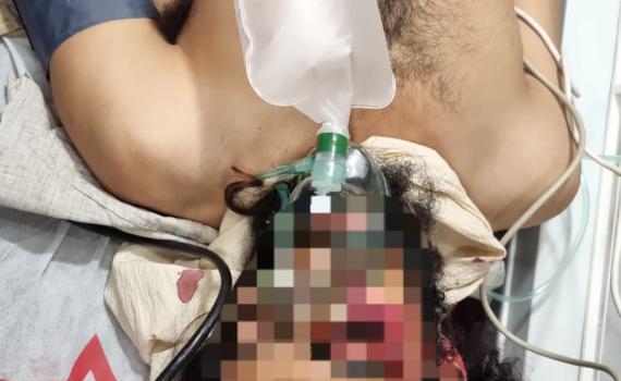 חוות מעון: ישראלי הותקף בראשו במעדר – מצבו קשה