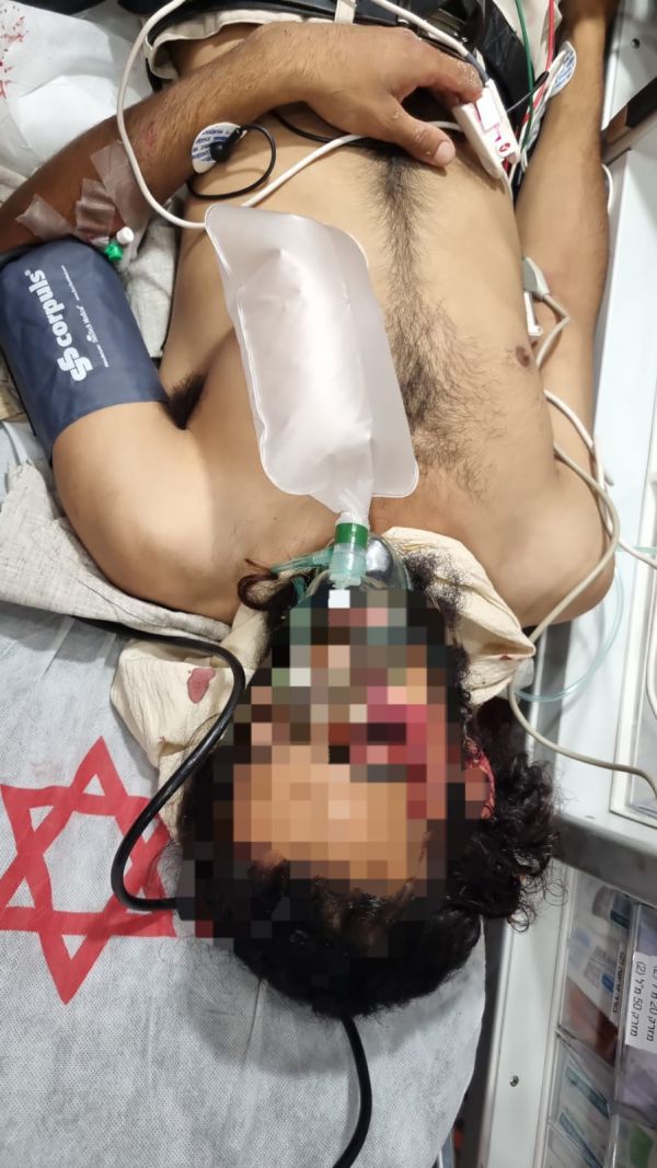 חוות מעון: ישראלי הותקף בראשו במעדר – מצבו קשה