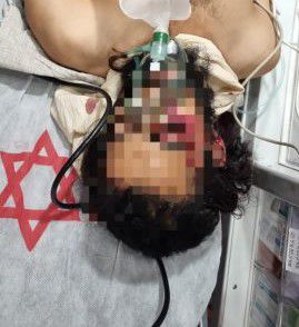 פצוע הלינץ' מהר חברון שב להכרה; מצבו קשה