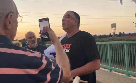 שוב: מפגינים נגד נתניהו הותקפו בהוד השרון
