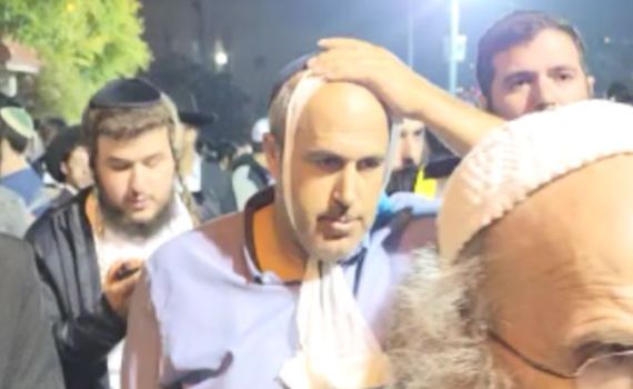 הרב שמואל אליהו הותקף על ידי חסידי ברלנד