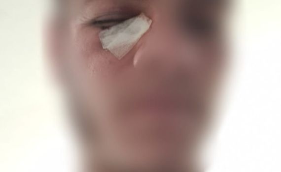 ערבי תקף חרדים ושוחרר ממעצר לאחר 3 שעות