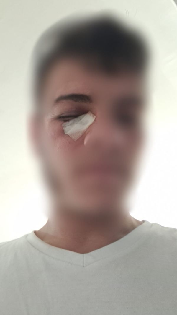 ערבי תקף חרדים ושוחרר ממעצר לאחר 3 שעות