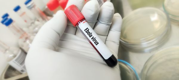 משרד הבריאות: להתכונן למקרה חשוד של אבולה