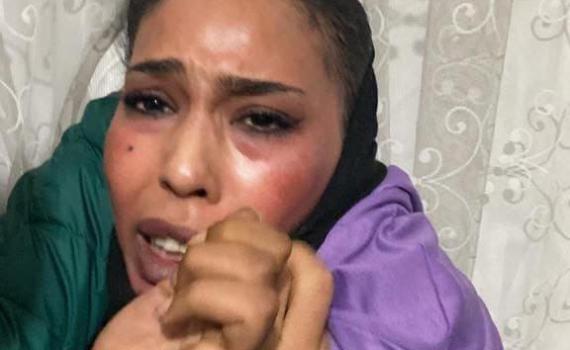 כך נלכדה המחבלת שביצעה את הפיגוע בטורקיה