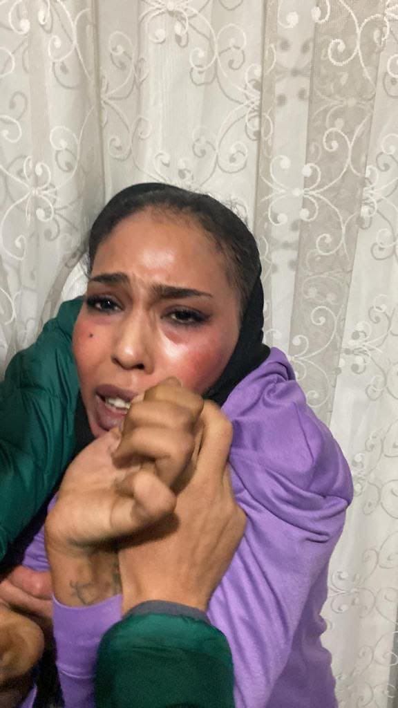 כך נלכדה המחבלת שביצעה את הפיגוע בטורקיה