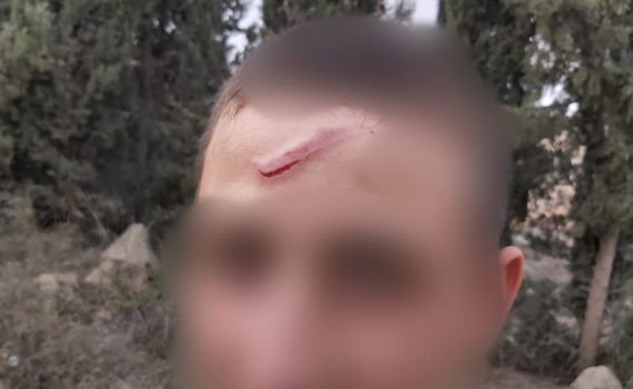 במחאה על הפיגוע: שוטר מג"ב פצע נער בן 14