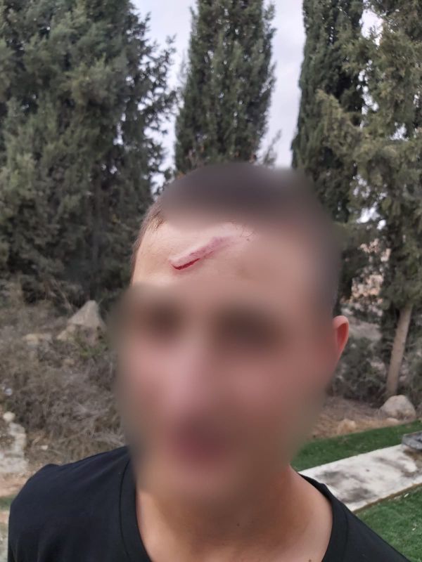 במחאה על הפיגוע: שוטר מג"ב פצע נער בן 14