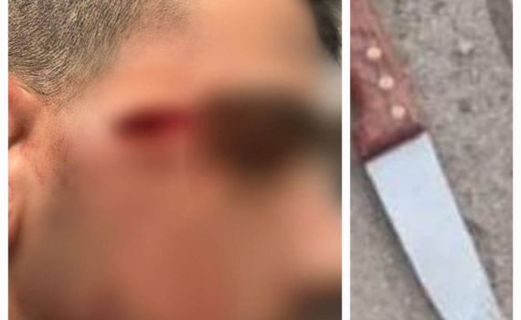 הלוחם שנטרל את המחבל: חששתי מפיגוע משמעותי