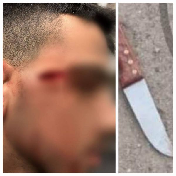 הלוחם שנטרל את המחבל: חששתי מפיגוע משמעותי