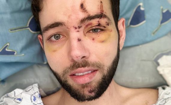 יוני קדם בתיעוד ראשון מבית החולים: "בין חיים למוות"