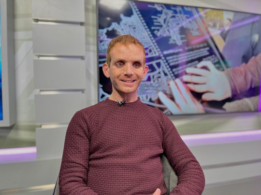 אביחי שלי לסרוגים: "הילדים שלי מקבלים את המוגבלות"