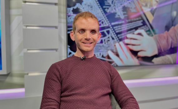 אביחי שלי לסרוגים: "הילדים שלי מקבלים את המוגבלות"