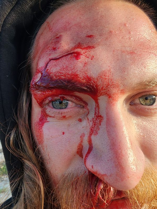 רועה צאן נפגע בראשו מהתקפת אבנים של ערבים