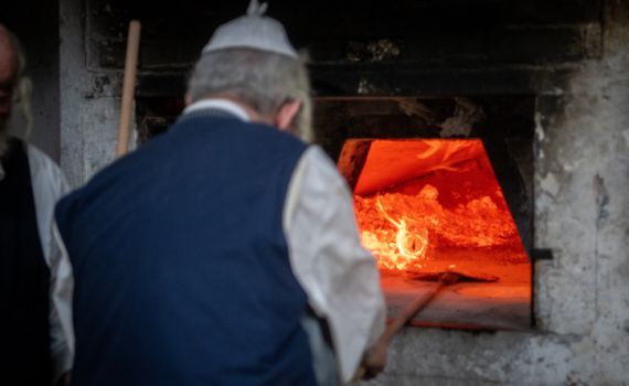 גבר מהשומרון נכווה כוויות קשות באפיית מצות