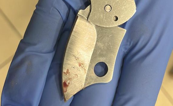 אירוע הדקירה בלוד: מעצרו של הנער הדוקר הוארך