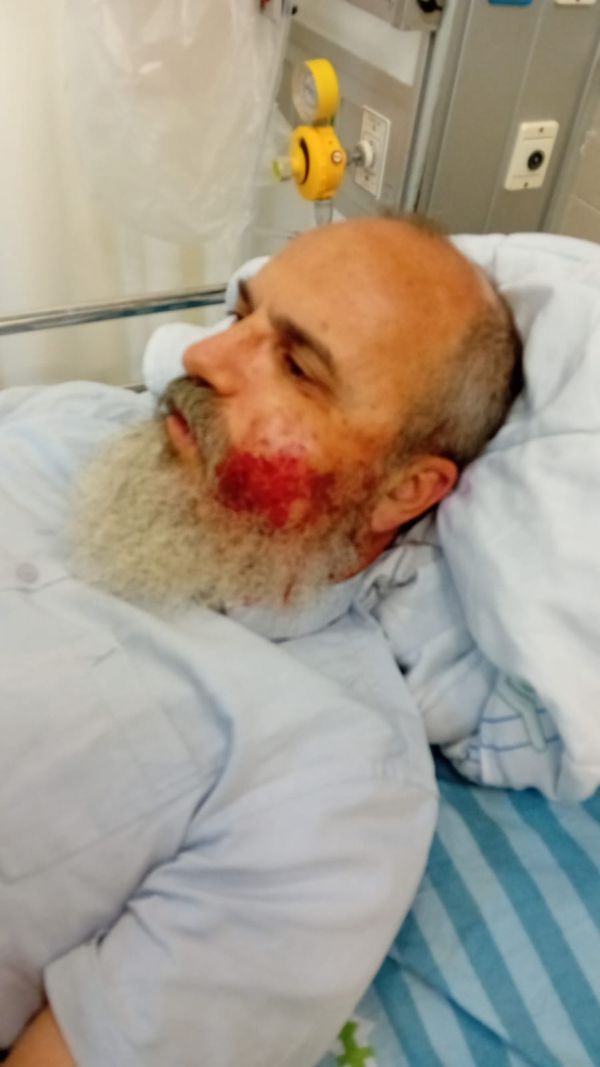 "ניסיון לרצח": עמנואל שילה נפצע בפיגוע אבנים