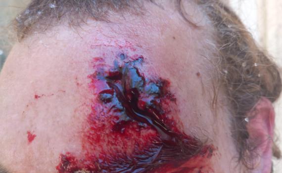 מחבלים הציתו שריפה סמוך לחומש ותקפו מתיישבים