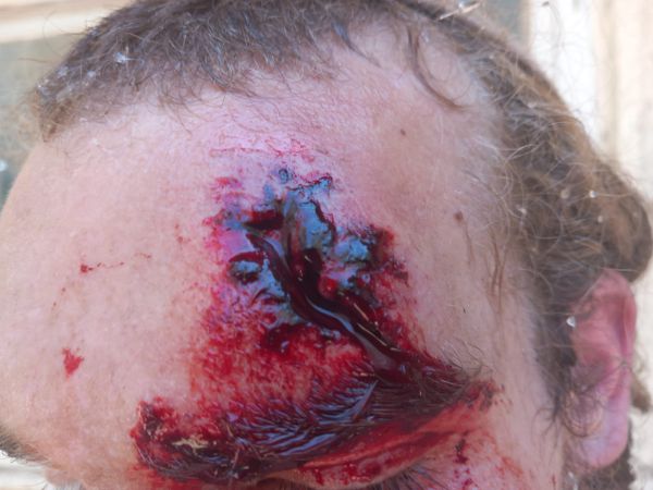 מחבלים הציתו שריפה סמוך לחומש ותקפו מתיישבים