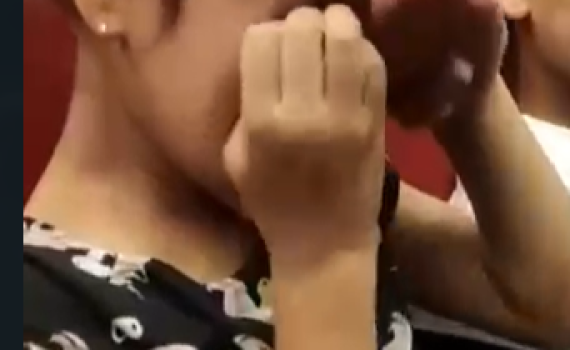 "לא ישבה לידו": התגובה האלרגית מהרחת הבוטנים