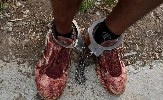 ניסיון רצח בקריית גת: המשטרה פתחה בחקירה