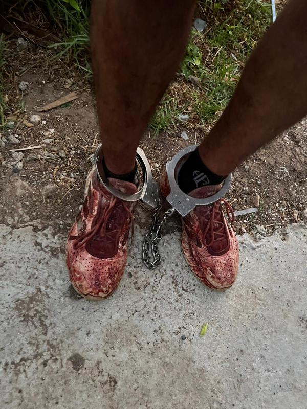 ניסיון רצח בקריית גת: המשטרה פתחה בחקירה