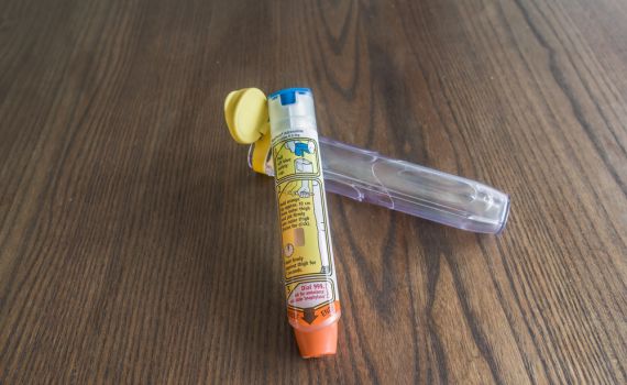 אלרגיה מסכנת חיים? הורים מודאגים משינוי בהנחיות