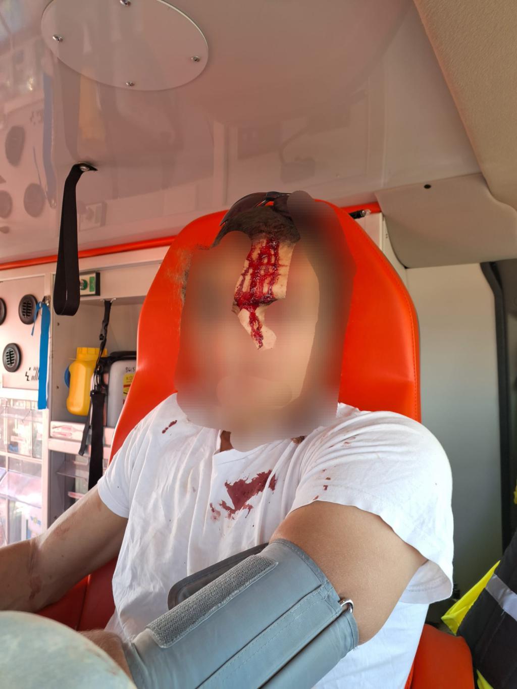 לינץ' בשומרון: רועה צאן הוכה באלות על ידי מחבלים