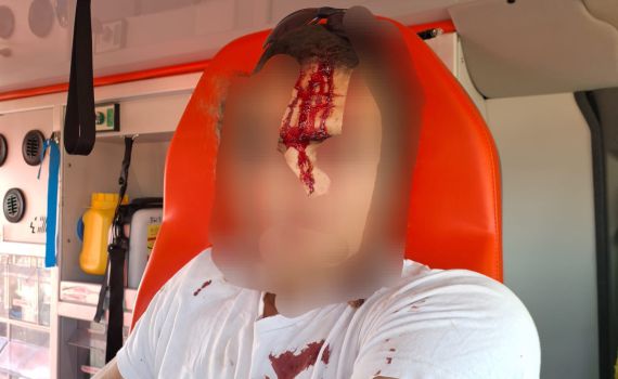 לינץ' בשומרון: רועה צאן הוכה באלות על ידי מחבלים