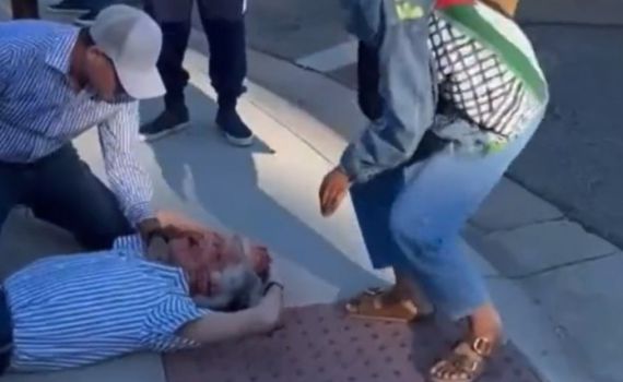 אנטישמיות ברחבי העולם: יהודי הוכה למוות בידי מפגין