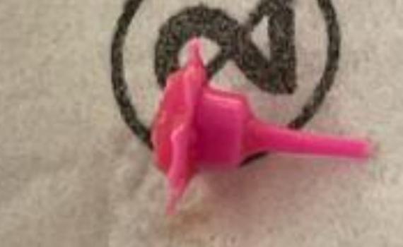 נס בירושלים: תינוק ניצל לאחר שבלע מחזיק נר