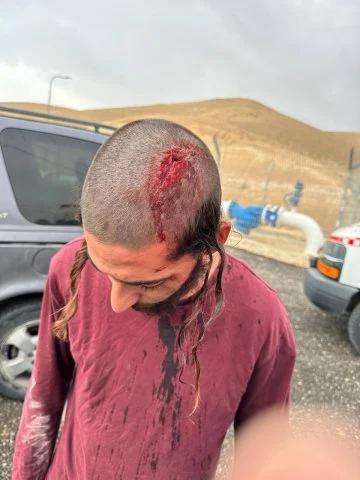 מצפה יריחו: פועלי פינוי אשפה תקפו ופצעו נער