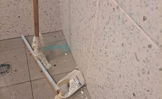 כמעט אסון בי-ם: שני ילדים נכוו לאחר שהדליקו אציטון