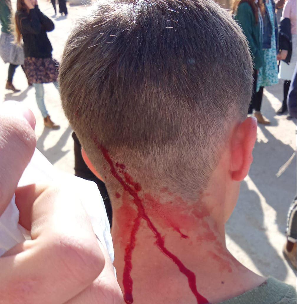 כרם שלום: חיילים פינו בכוח חוסמי משאיות