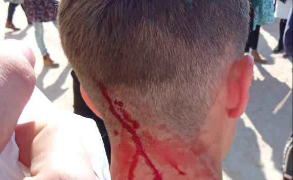 כרם שלום: חיילים פינו בכוח חוסמי משאיות