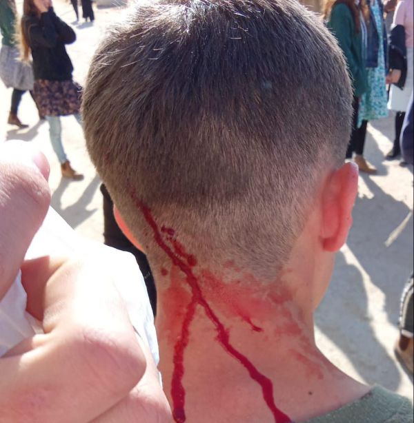 כרם שלום: חיילים פינו בכוח חוסמי משאיות