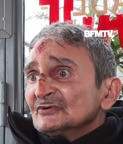 היהודי שנדקר בפריז: "בזיון והשפלה, לא יכולתי להתגונן"