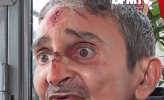 היהודי שנדקר בפריז: "בזיון והשפלה, לא יכולתי להתגונן"