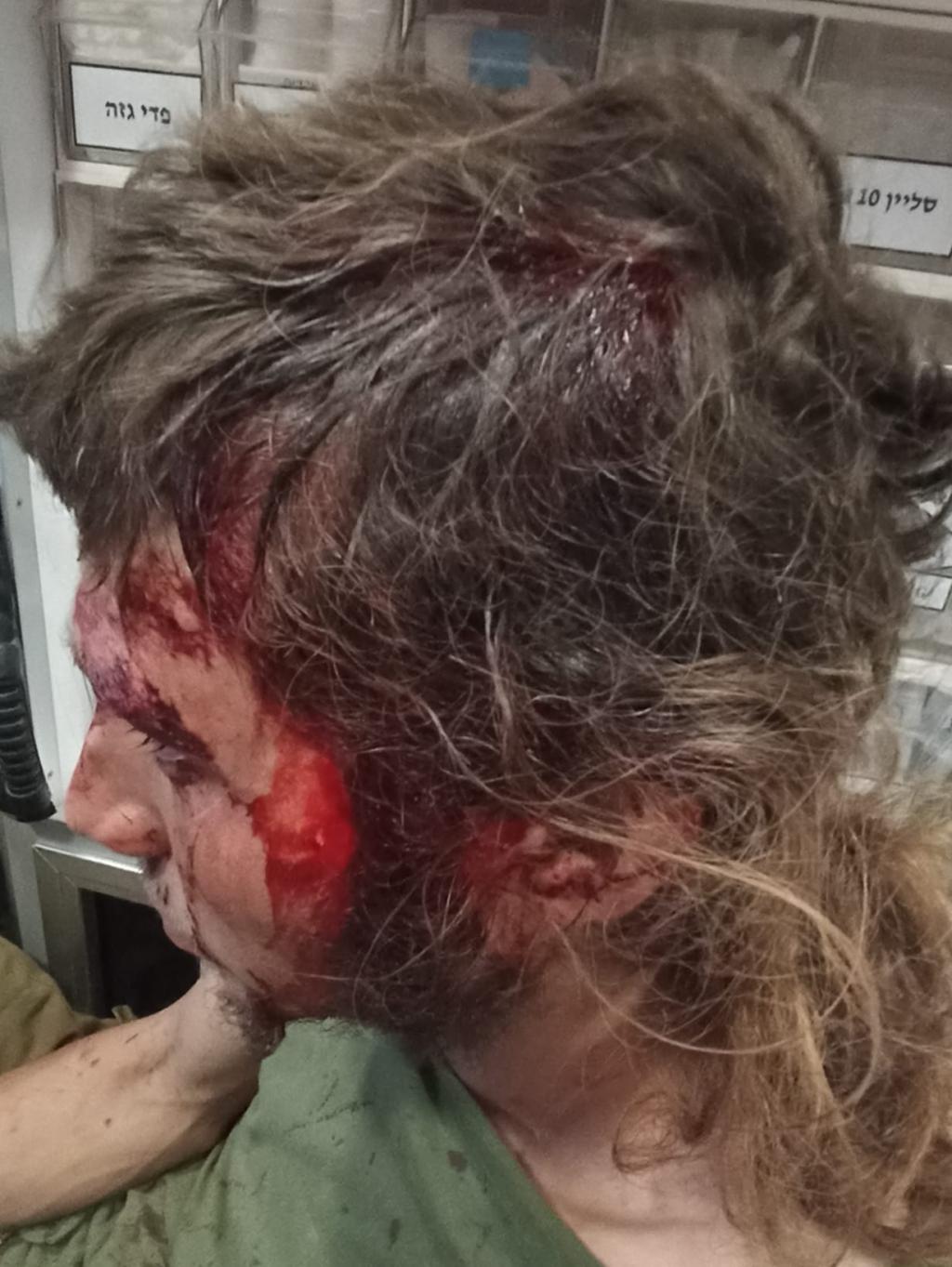 חצי שנה לאחר הלינץ': המחבלים שוחררו לביתם