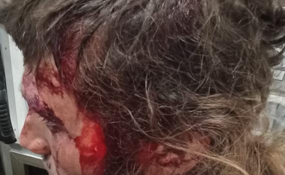 חצי שנה לאחר הלינץ': המחבלים שוחררו לביתם