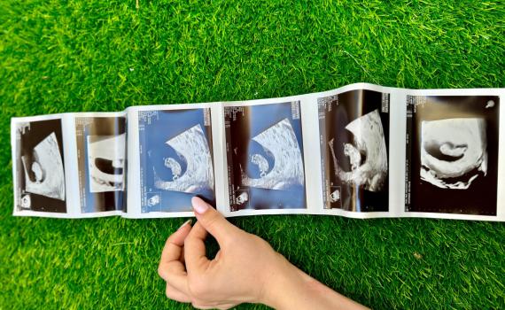 העיתונאית החרדית חושפת: היריון חמישי בגיל 29