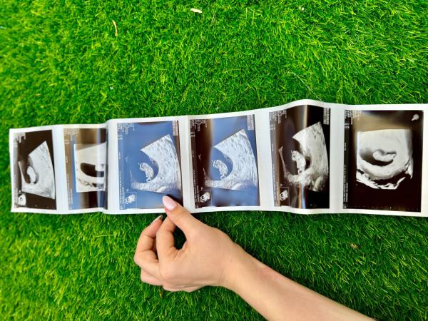 העיתונאית החרדית חושפת: היריון חמישי בגיל 29