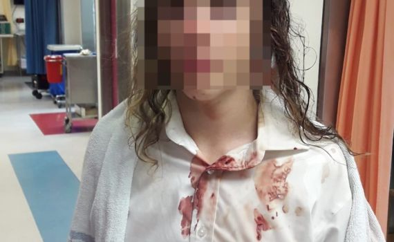 חודש אחרי תקיפת נער באלה: טענות נגד מח"ש בעיכוב החקירה