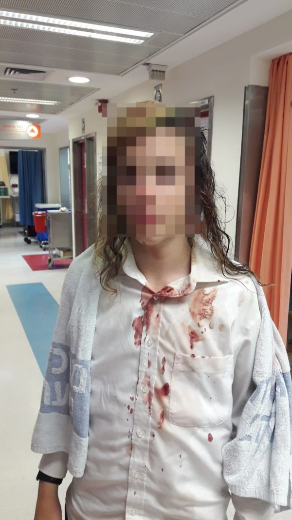 חודש אחרי תקיפת נער באלה: טענות נגד מח"ש בעיכוב החקירה