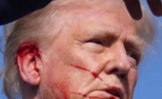 טראמפ נפצע בניסיון התנקשות – היורה חוסל