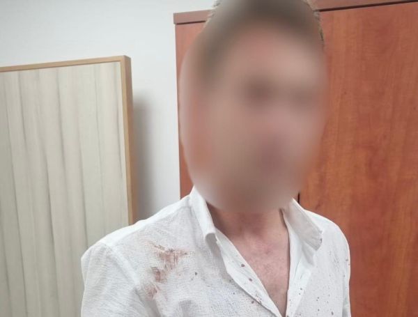 חשד: ערבי תקף את זוגתו לשעבר וגרם לה לחבלות בראש