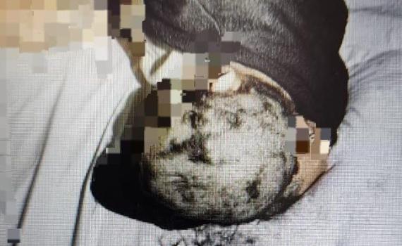 סימם, גילח את ראשן ותקף מינית: פרשה חמורה בבני ברק