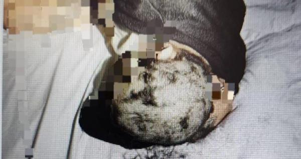 סימם, גילח את ראשן ותקף מינית: פרשה חמורה בבני ברק